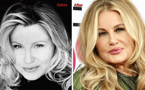 jennifer coolidge before surgery|Comedian Jennifer Coolidge explains Hollywood。